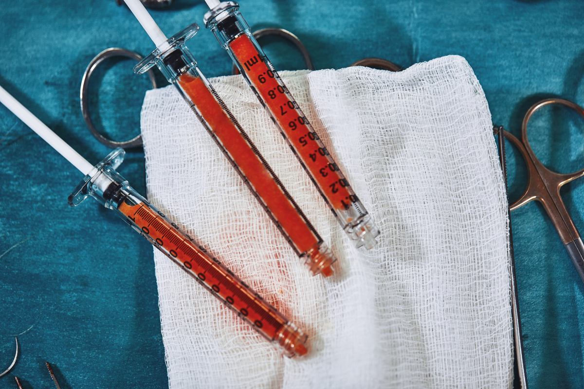 Close up of syringes with fat for fat injections on sterile table